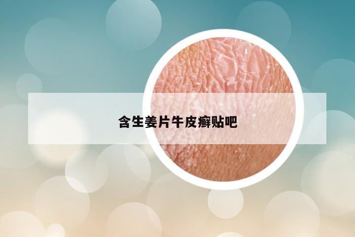 含生姜片牛皮癣贴吧