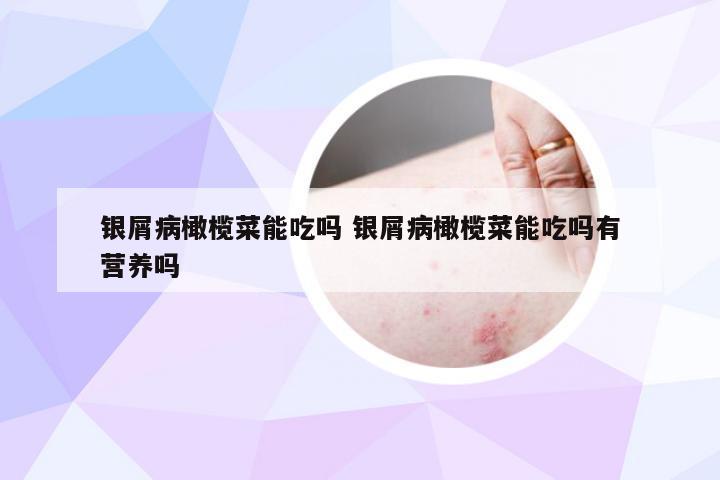 银屑病橄榄菜能吃吗 银屑病橄榄菜能吃吗有营养吗