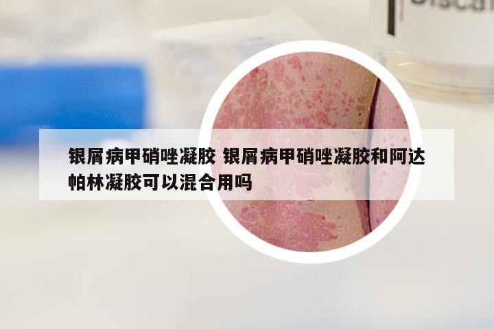 银屑病甲硝唑凝胶 银屑病甲硝唑凝胶和阿达帕林凝胶可以混合用吗