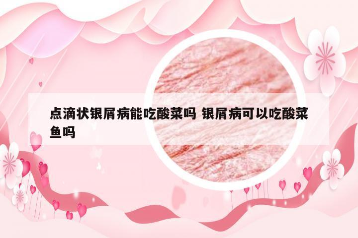 点滴状银屑病能吃酸菜吗 银屑病可以吃酸菜鱼吗