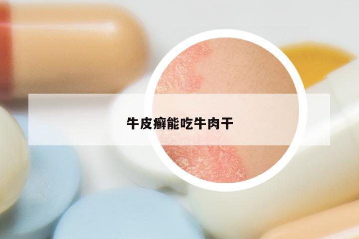 牛皮癣能吃牛肉干
