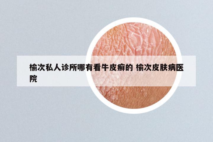 榆次私人诊所哪有看牛皮癣的 榆次皮肤病医院