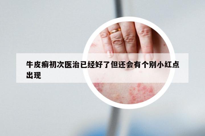 牛皮癣初次医治已经好了但还会有个别小红点出现
