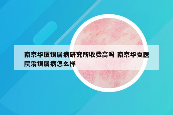 南京华厦银屑病研究所收费高吗 南京华夏医院治银屑病怎么样