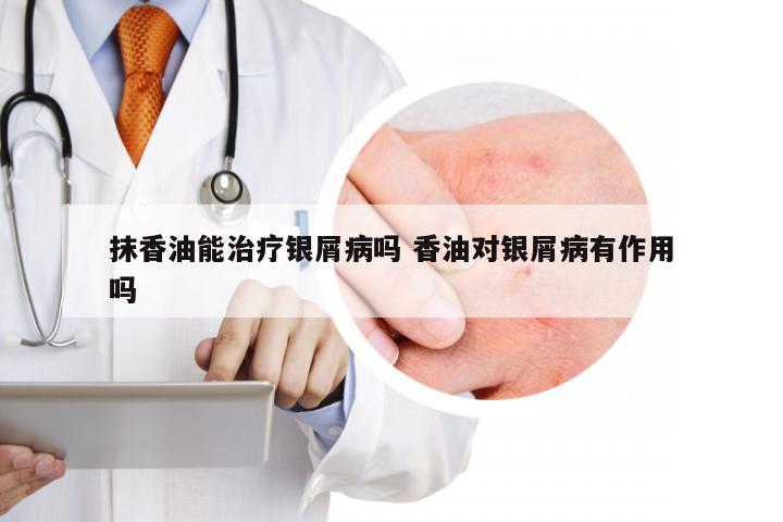 抹香油能治疗银屑病吗 香油对银屑病有作用吗