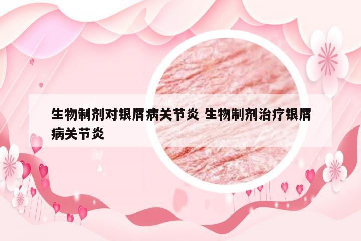 生物制剂对银屑病关节炎 生物制剂治疗银屑病关节炎