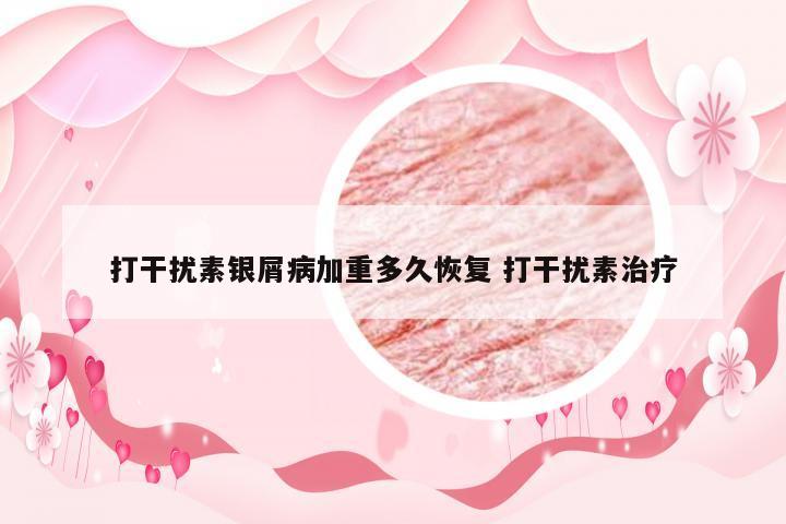 打干扰素银屑病加重多久恢复 打干扰素治疗