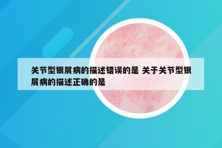 关节型银屑病的描述错误的是 关于关节型银屑病的描述正确的是