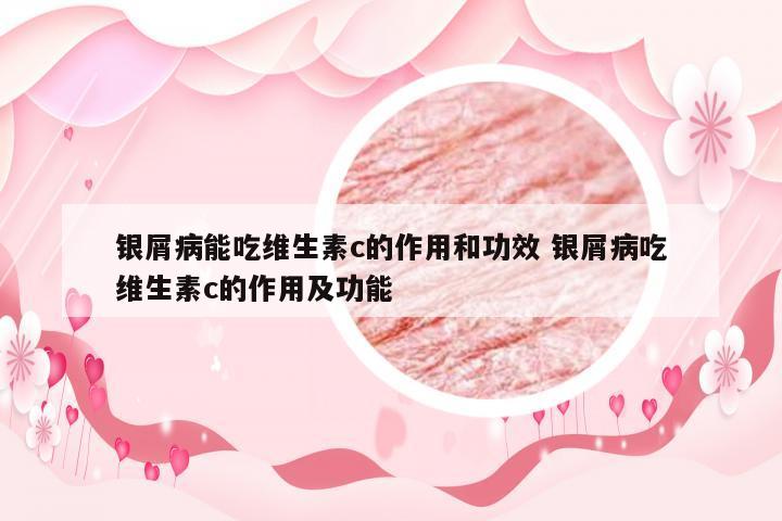 银屑病能吃维生素c的作用和功效 银屑病吃维生素c的作用及功能