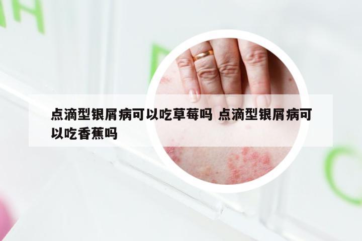 点滴型银屑病可以吃草莓吗 点滴型银屑病可以吃香蕉吗