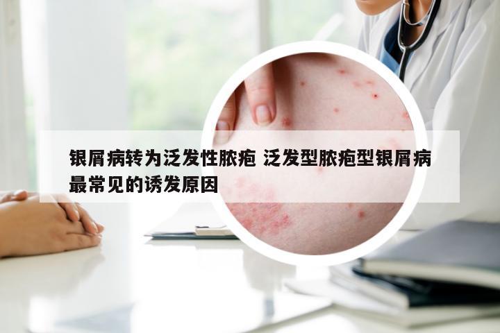 银屑病转为泛发性脓疱 泛发型脓疱型银屑病最常见的诱发原因