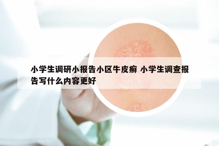 小学生调研小报告小区牛皮癣 小学生调查报告写什么内容更好