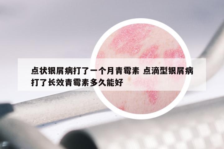 点状银屑病打了一个月青霉素 点滴型银屑病打了长效青霉素多久能好