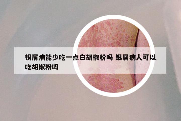 银屑病能少吃一点白胡椒粉吗 银屑病人可以吃胡椒粉吗