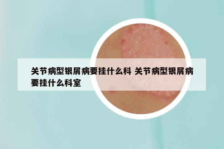 关节病型银屑病要挂什么科 关节病型银屑病要挂什么科室