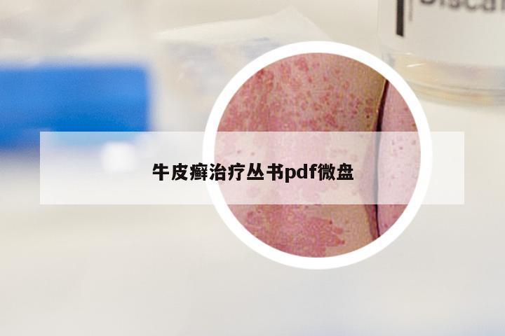 牛皮癣治疗丛书pdf微盘