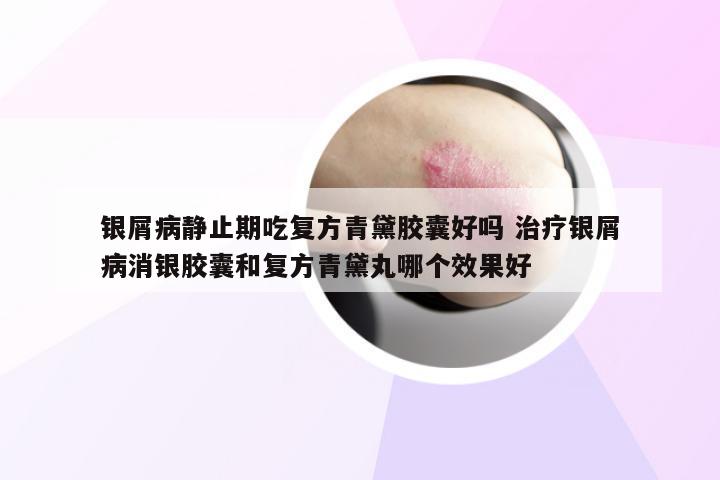 银屑病静止期吃复方青黛胶囊好吗 治疗银屑病消银胶囊和复方青黛丸哪个效果好