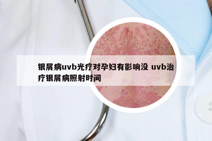 银屑病uvb光疗对孕妇有影响没 uvb治疗银屑病照射时间