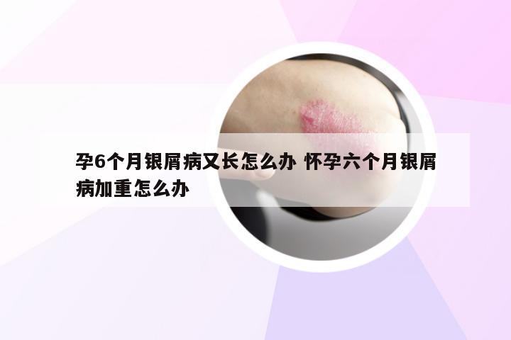 孕6个月银屑病又长怎么办 怀孕六个月银屑病加重怎么办
