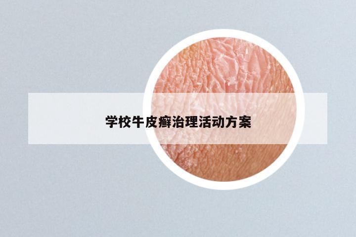 学校牛皮癣治理活动方案