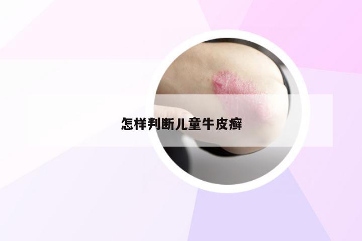 怎样判断儿童牛皮癣