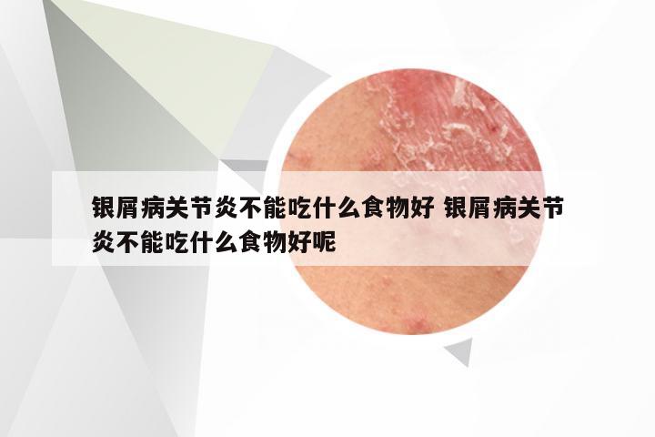 银屑病关节炎不能吃什么食物好 银屑病关节炎不能吃什么食物好呢