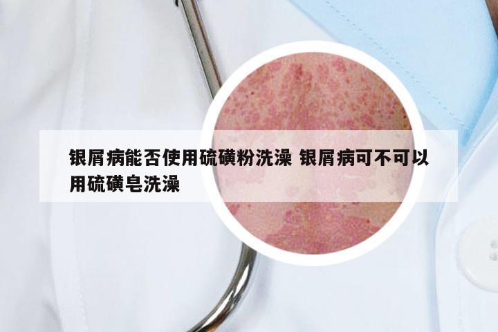 银屑病能否使用硫磺粉洗澡 银屑病可不可以用硫磺皂洗澡