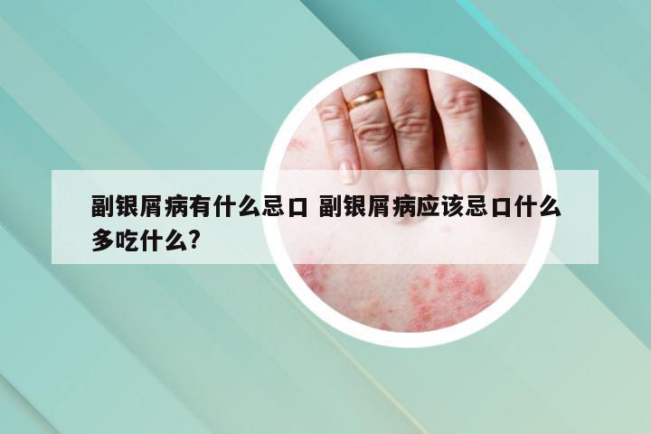 副银屑病有什么忌口 副银屑病应该忌口什么多吃什么?