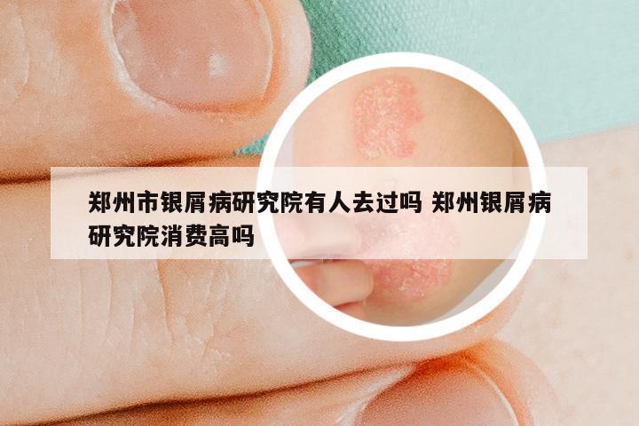 郑州市银屑病研究院有人去过吗 郑州银屑病研究院消费高吗