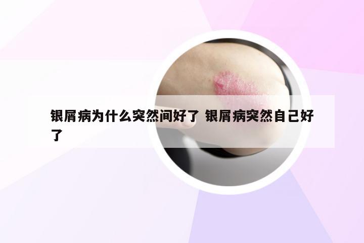 银屑病为什么突然间好了 银屑病突然自己好了