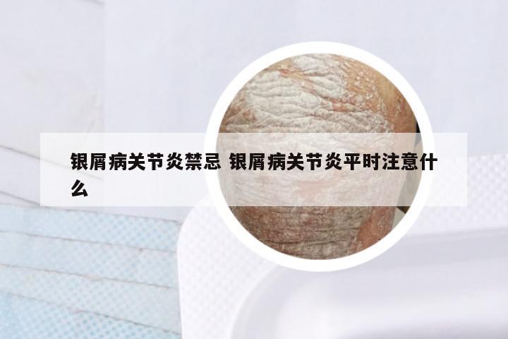 银屑病关节炎禁忌 银屑病关节炎平时注意什么