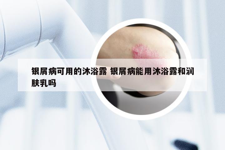 银屑病可用的沐浴露 银屑病能用沐浴露和润肤乳吗