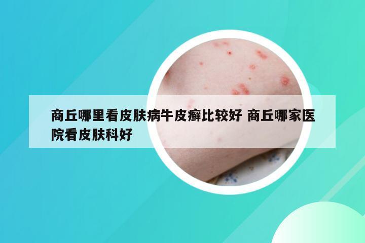商丘哪里看皮肤病牛皮癣比较好 商丘哪家医院看皮肤科好