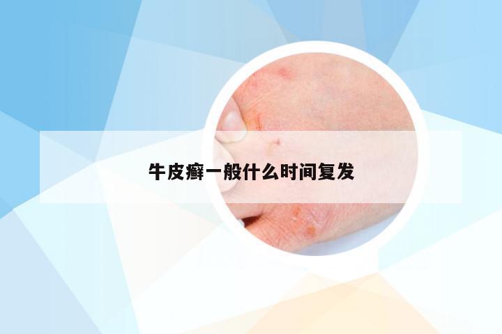 牛皮癣一般什么时间复发