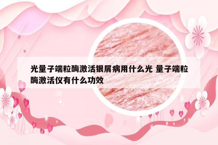 光量子端粒酶激活银屑病用什么光 量子端粒酶激活仪有什么功效