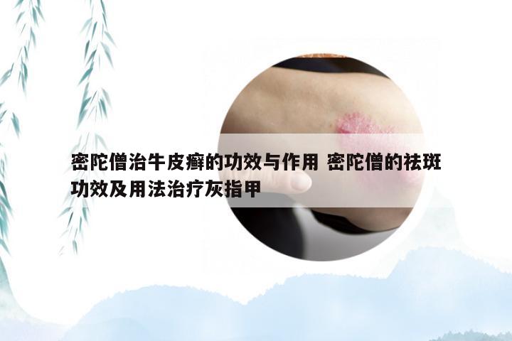 密陀僧治牛皮癣的功效与作用 密陀僧的祛斑功效及用法治疗灰指甲