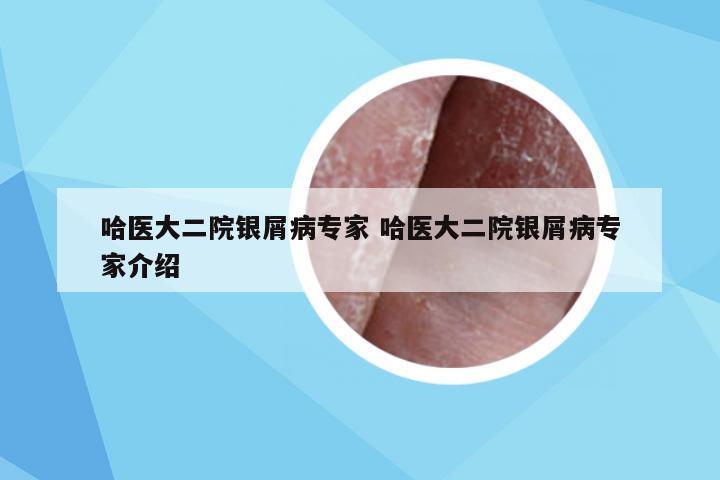 哈医大二院银屑病专家 哈医大二院银屑病专家介绍