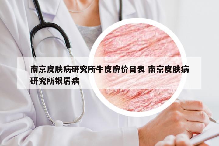 南京皮肤病研究所牛皮癣价目表 南京皮肤病研究所银屑病