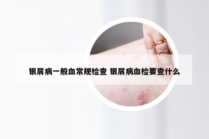 银屑病一般血常规检查 银屑病血检要查什么