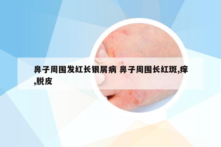 鼻子周围发红长银屑病 鼻子周围长红斑,痒,脱皮