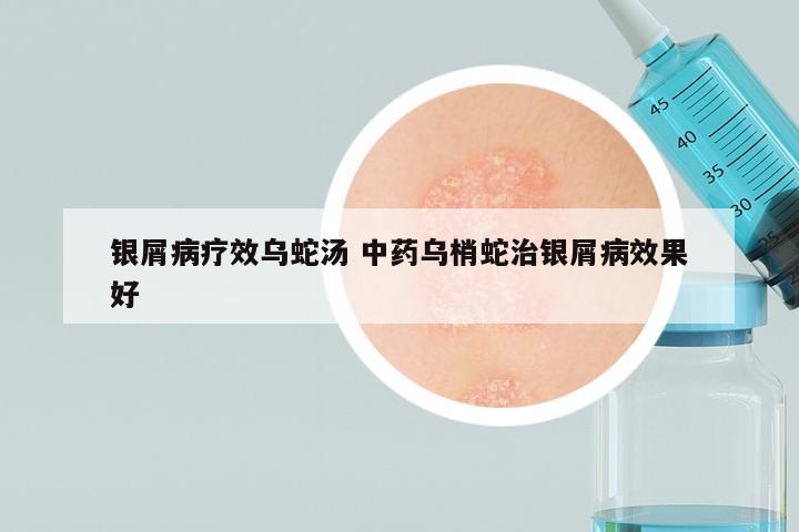银屑病疗效乌蛇汤 中药乌梢蛇治银屑病效果好