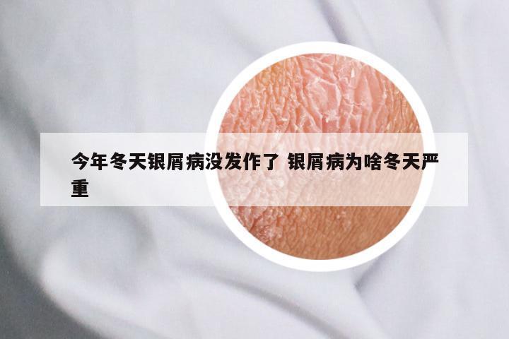 今年冬天银屑病没发作了 银屑病为啥冬天严重