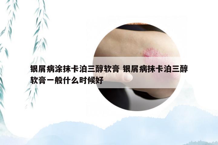银屑病涂抹卡泊三醇软膏 银屑病抹卡泊三醇软膏一般什么时候好