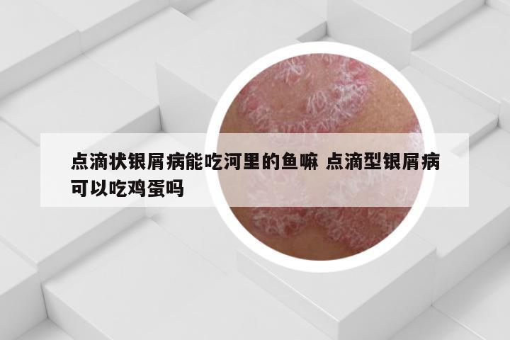 点滴状银屑病能吃河里的鱼嘛 点滴型银屑病可以吃鸡蛋吗