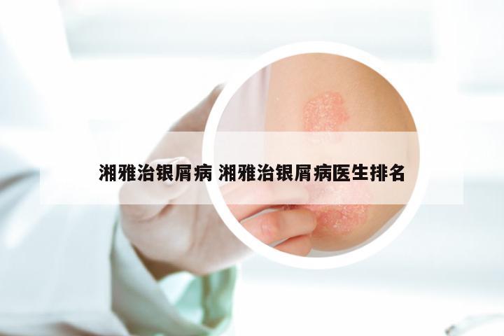 湘雅治银屑病 湘雅治银屑病医生排名