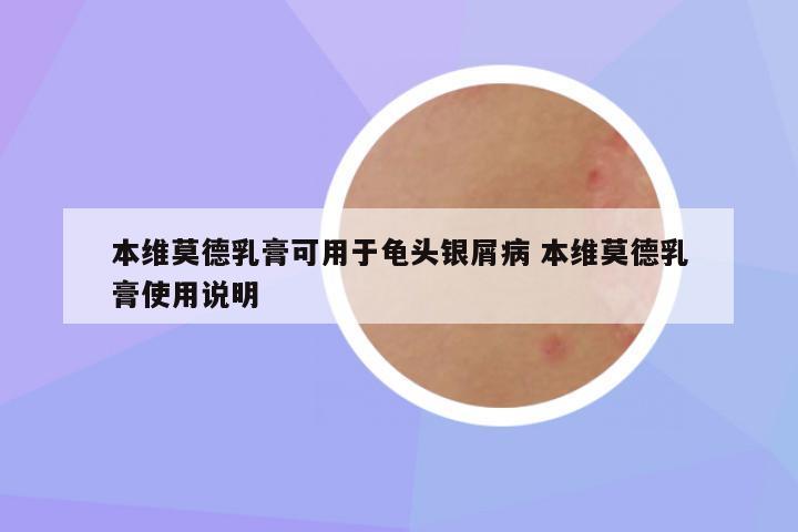 本维莫德乳膏可用于龟头银屑病 本维莫德乳膏使用说明