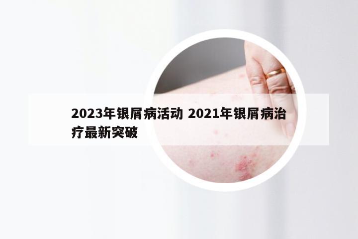 2023年银屑病活动 2021年银屑病治疗最新突破
