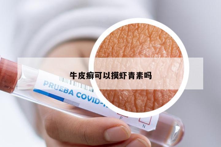 牛皮癣可以摸虾青素吗
