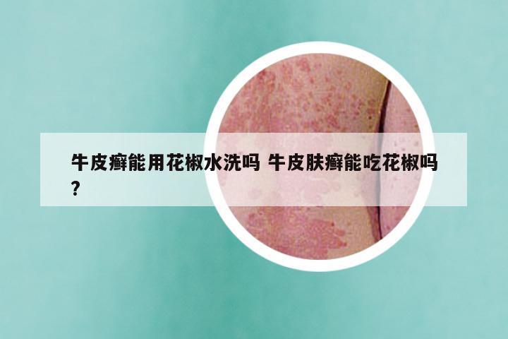 牛皮癣能用花椒水洗吗 牛皮肤癣能吃花椒吗?