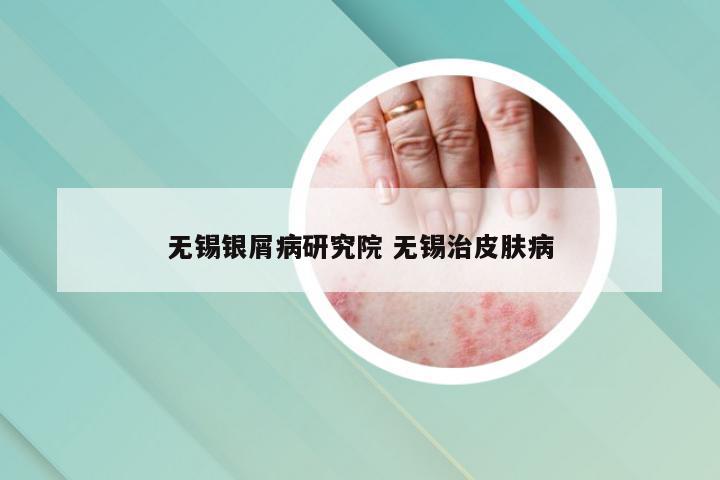 无锡银屑病研究院 无锡治皮肤病